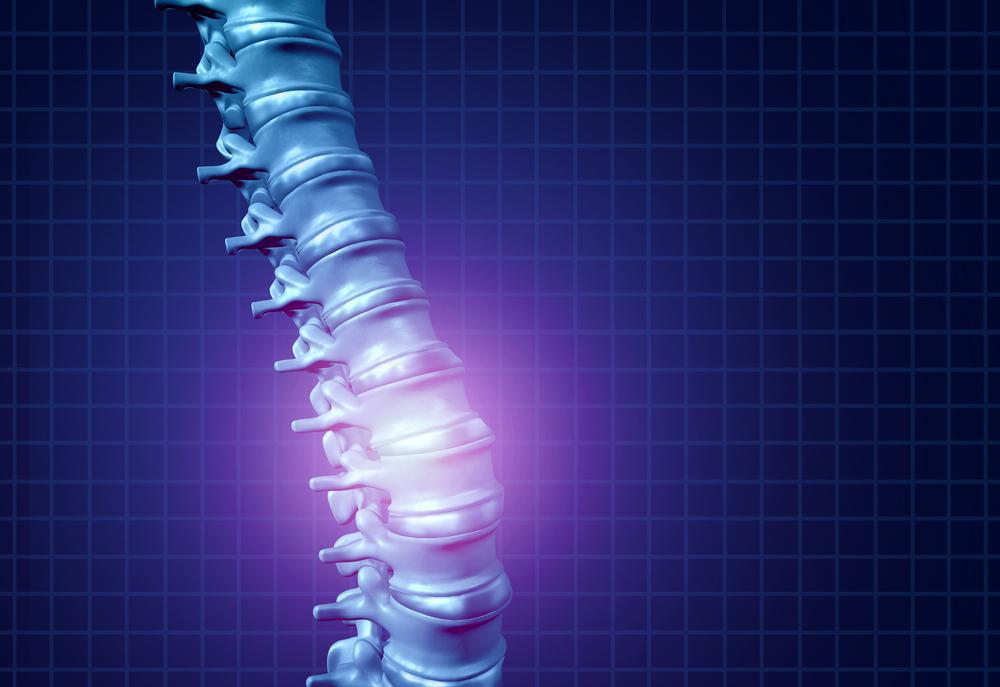 What is Spinal Cord Stimulation?